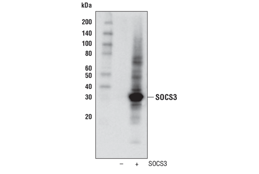 Jak/Stat Pathway Inhibitors Antibody Sampler Kit