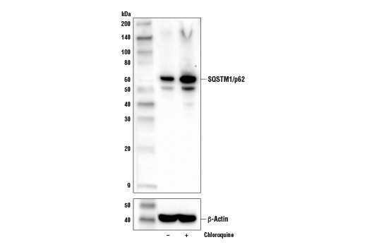 SQSTM1/p62 (D6M5X) Rabbit mAb