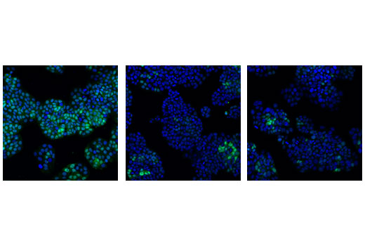 CDK Antibody Sampler Kit