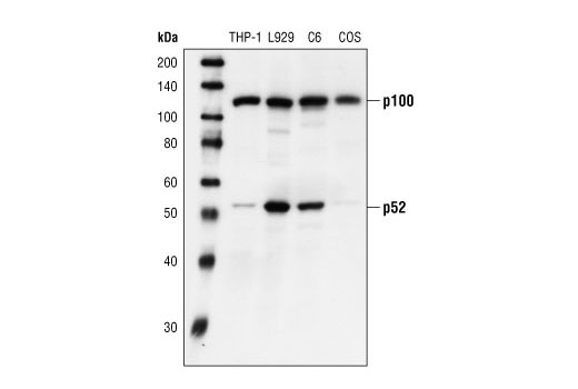 NF-kappaB Family Member Antibody Sampler Kit