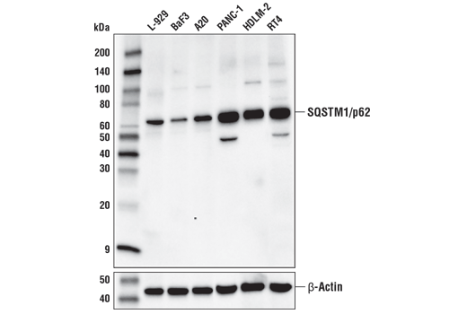 p62/KEAP1/NRF2 Pathway Antibody Sampler Kit