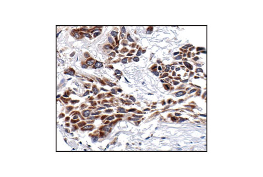 NF-kappaB Family Member Antibody Sampler Kit