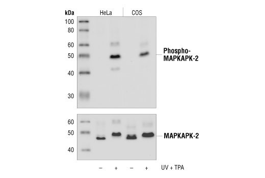 Phospho-p38 MAPK Pathway Antibody Sampler Kit