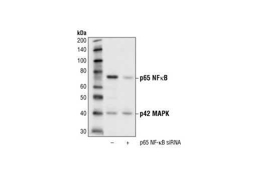 SignalSilence ®  NF-kappaB p65 siRNA I