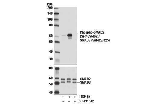 TGF-beta Fibrosis Pathway Antibody Sampler Kit