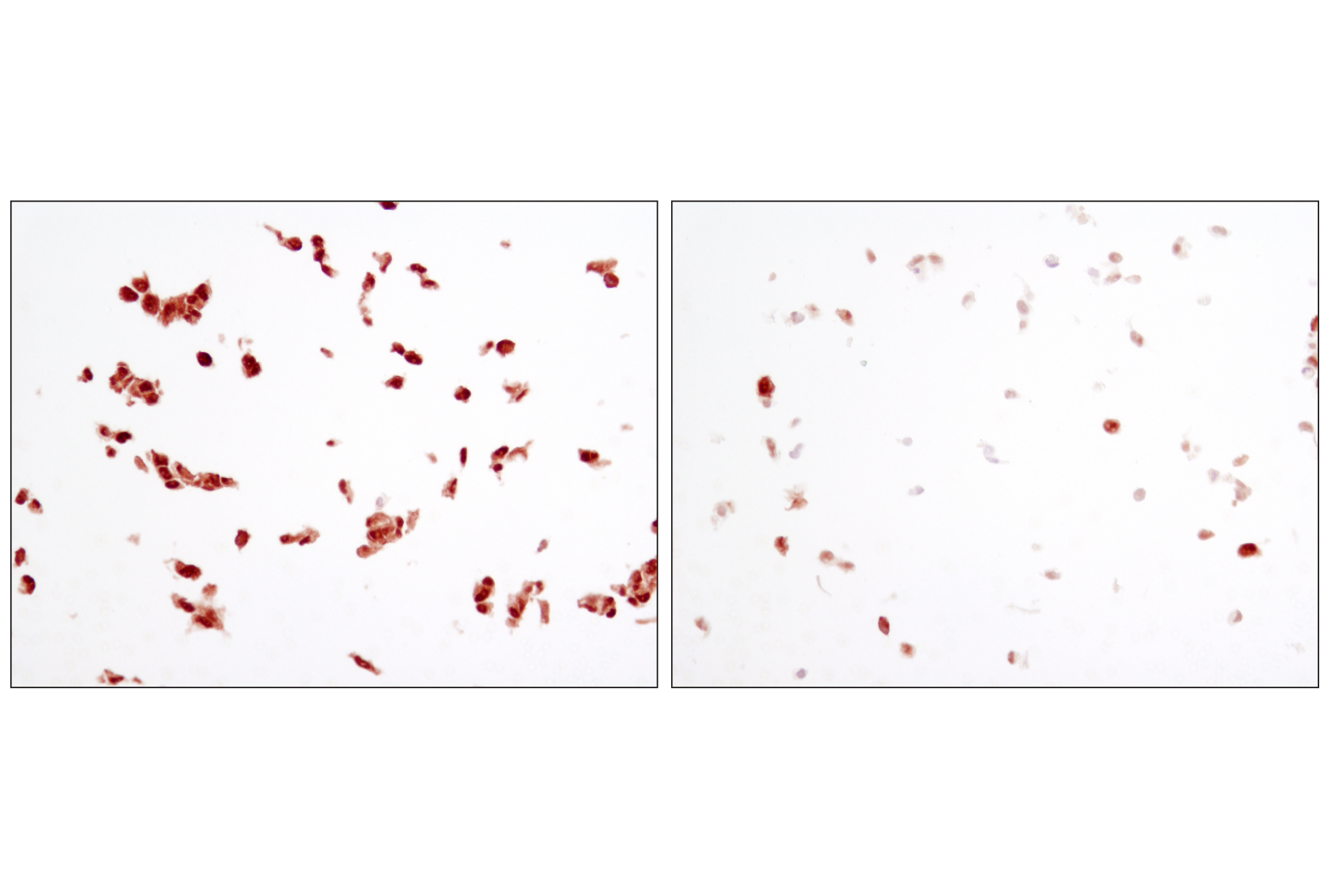 NF-kappaB Family Member Antibody Sampler Kit