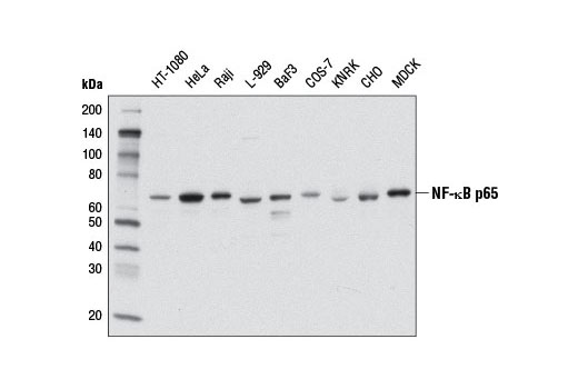 NF-kappaB p65 (L8F6) Mouse mAb