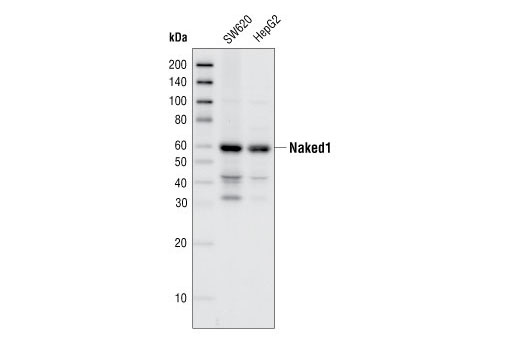 Wnt Signaling Antibody Sampler Kit