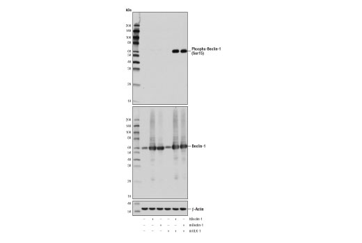 Phospho-Beclin-1 (Ser15) (D4B7R) Rabbit mAb