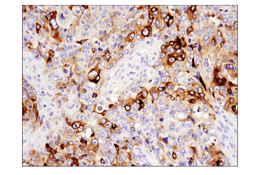 TGF-beta Fibrosis Pathway Antibody Sampler Kit