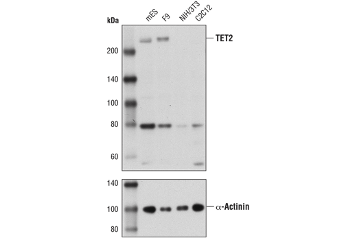 TET2 (D9K3E) Rabbit mAb