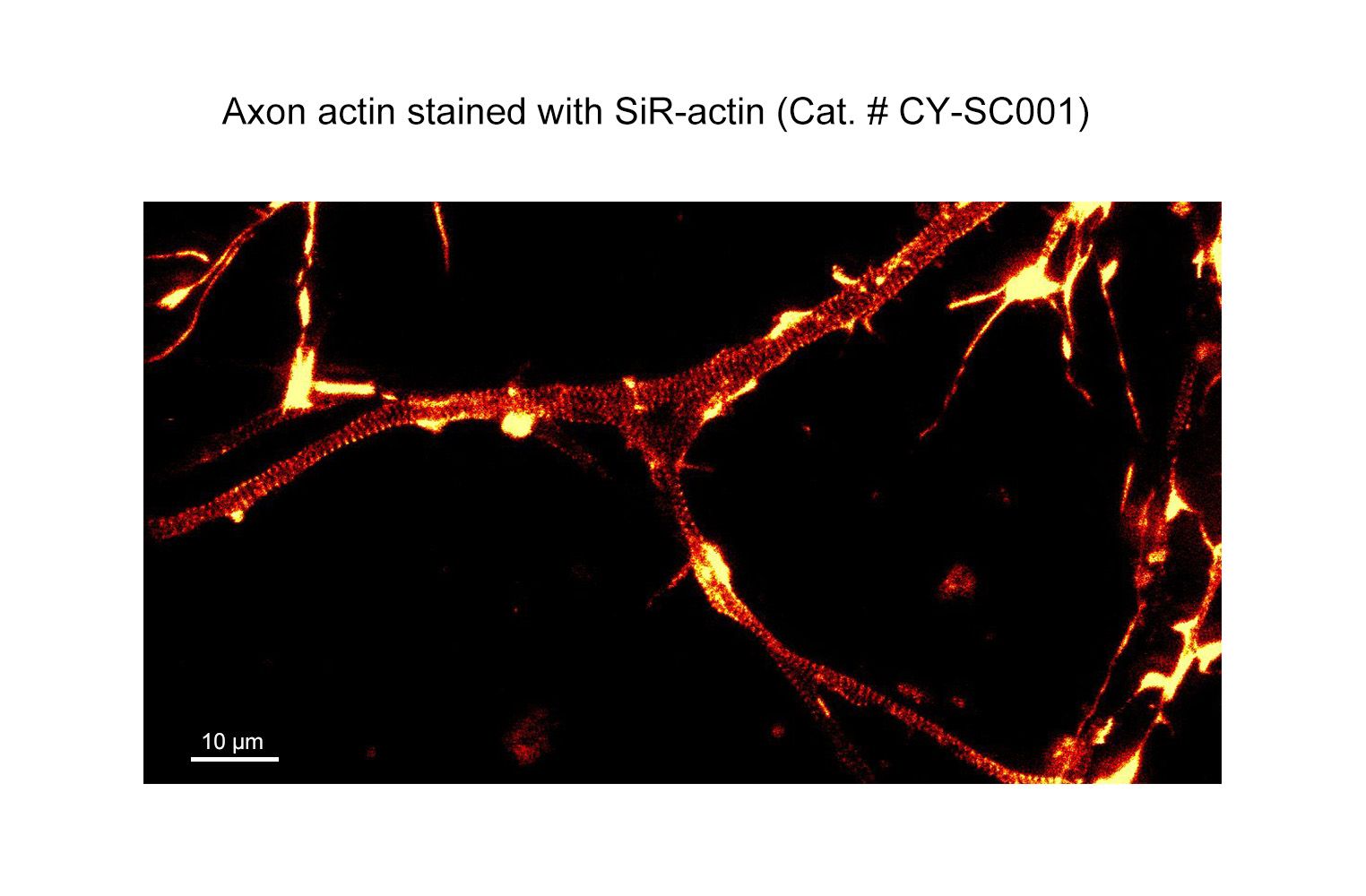 SiR-Actin Kit