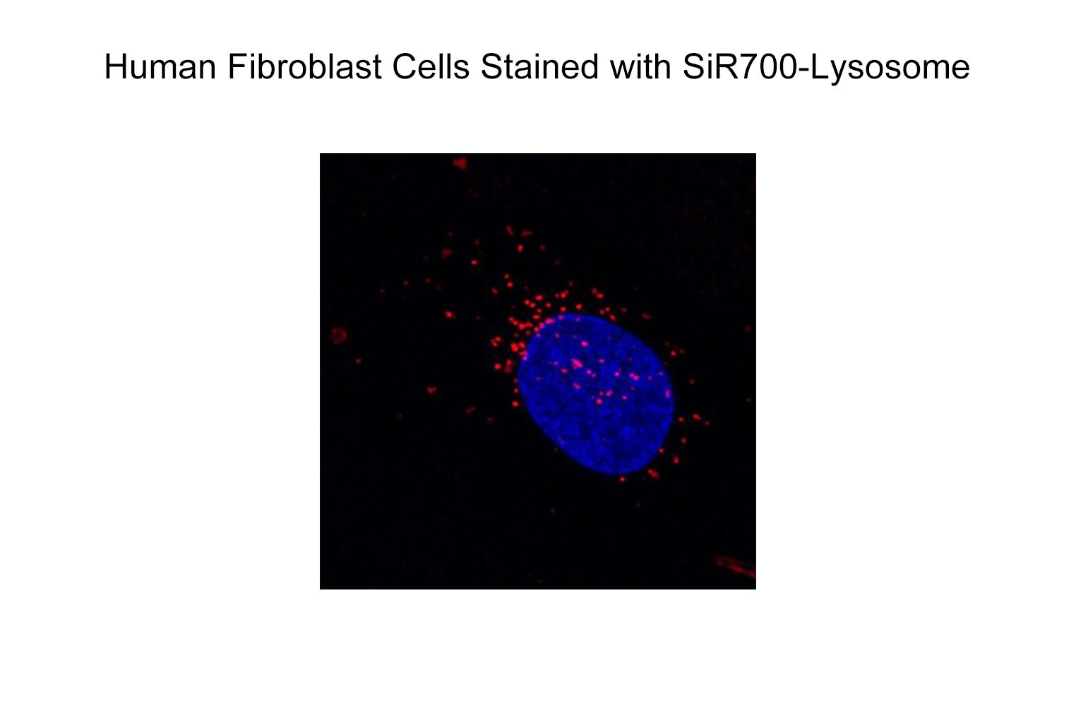 SiR700-Lysosome Kit