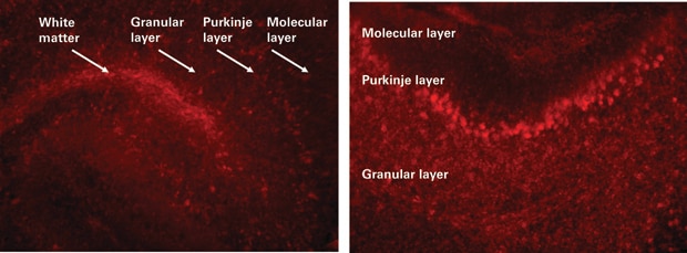 organotypic brain slices