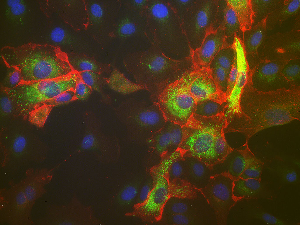 HPAEC-Pulmon. Artery Endo ,EGM-2, amp