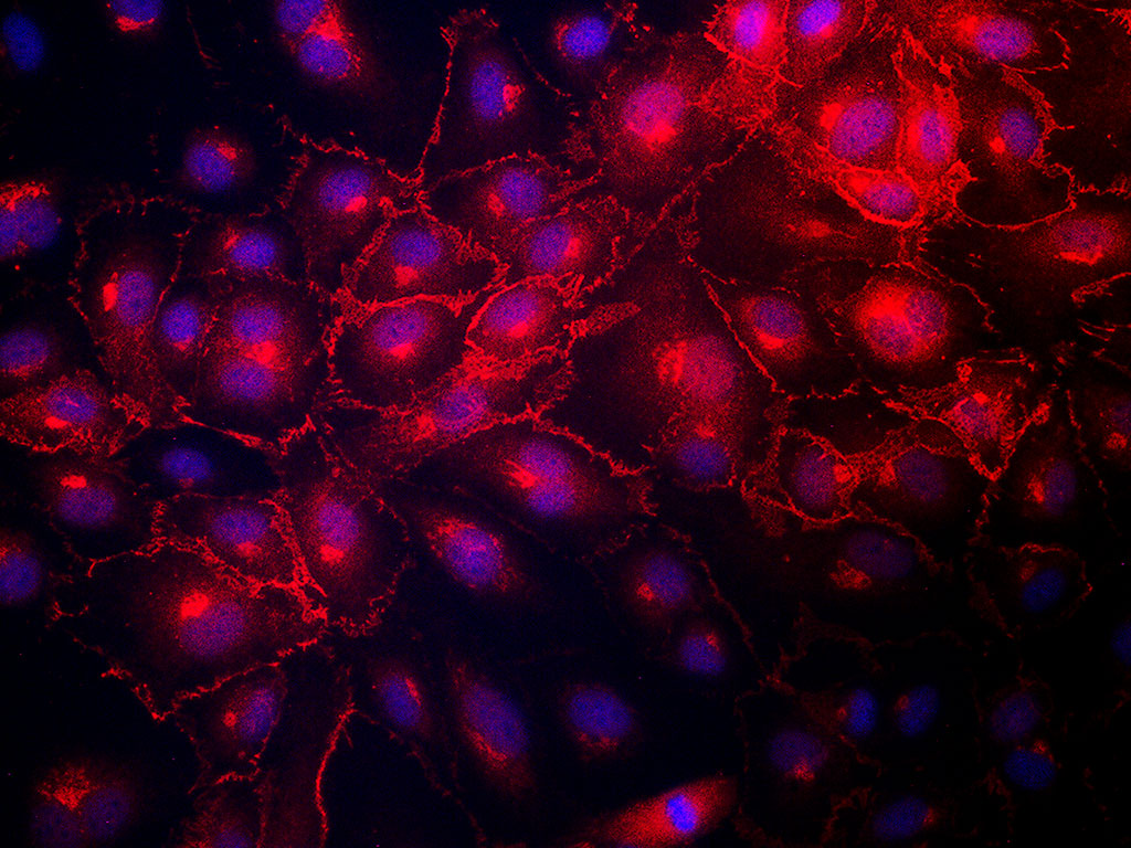 HAEC-Aortic Endothelial EGM-2, cryo