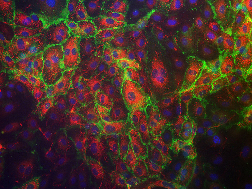 HAEC-Aortic Endothelial EGM-2, cryo