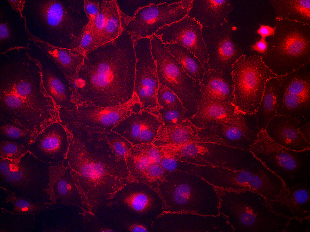 HAEC-Aortic Endothelial EGM-2, cryo