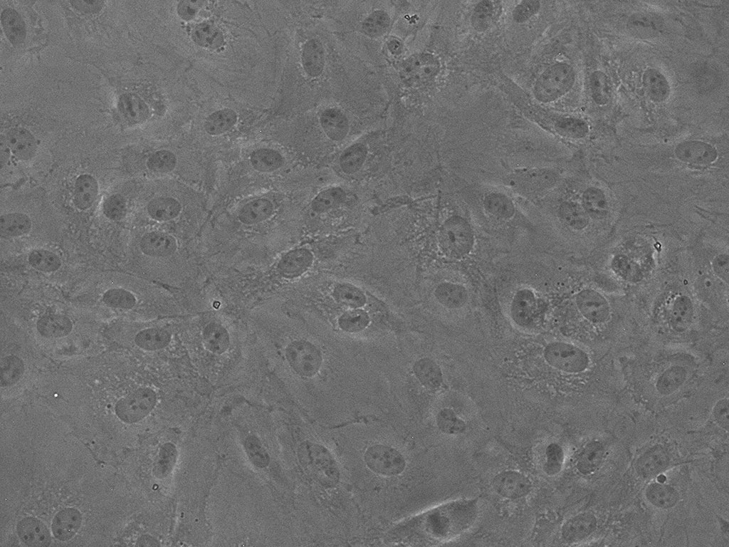 HAEC-Aortic Endothelial EGM-2, cryo