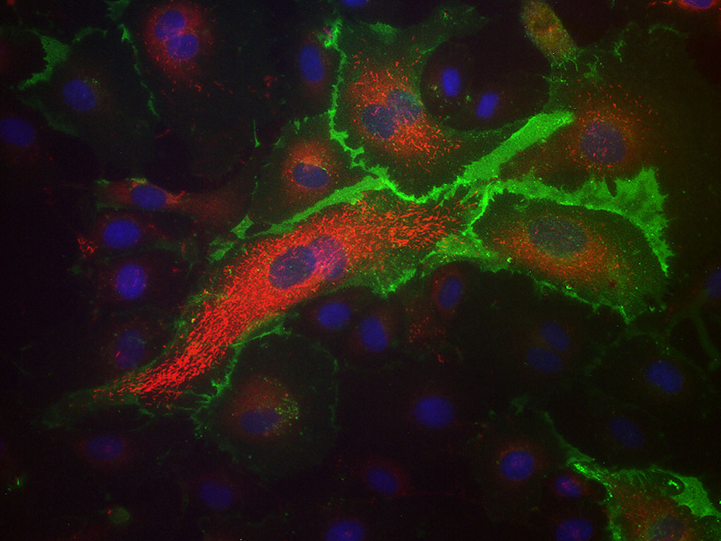 HAEC-Aortic Endothelial EGM-2, cryo