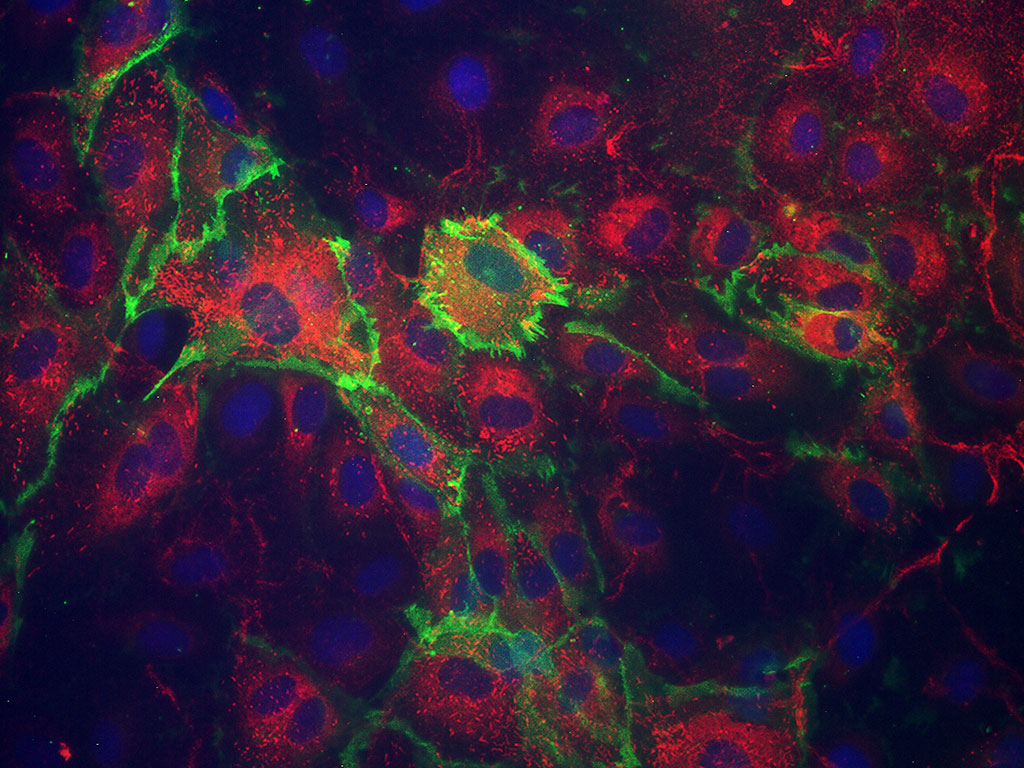 HAEC-Aortic Endothelial EGM-2, cryo