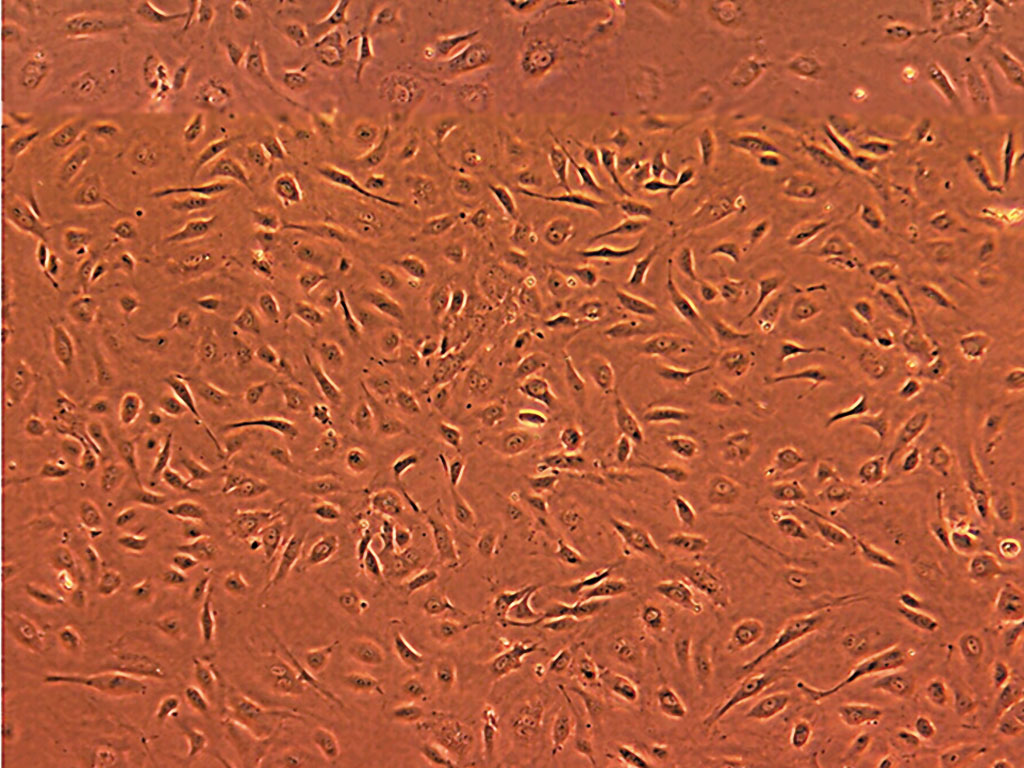 HAEC-Aortic Endothelial EGM-2, cryo