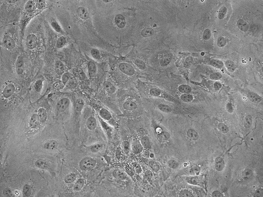 HAEC-Aortic Endothelial EGM-2, cryo