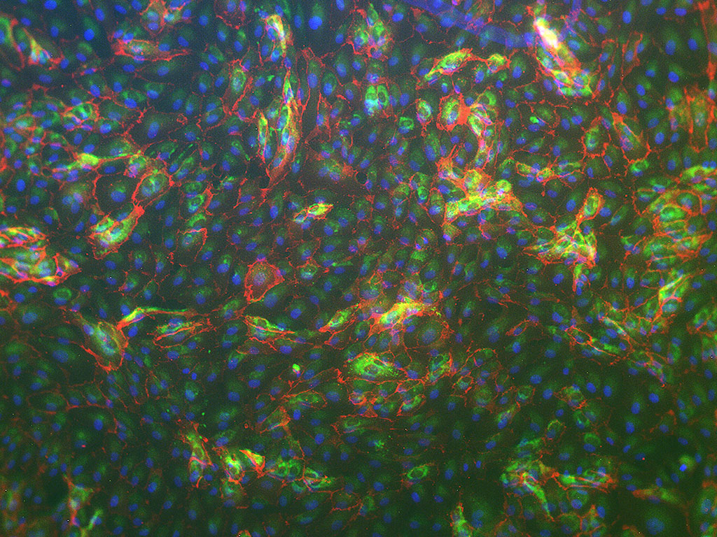 HPAEC-Pulmon. Artery Endo ,EGM-2, amp