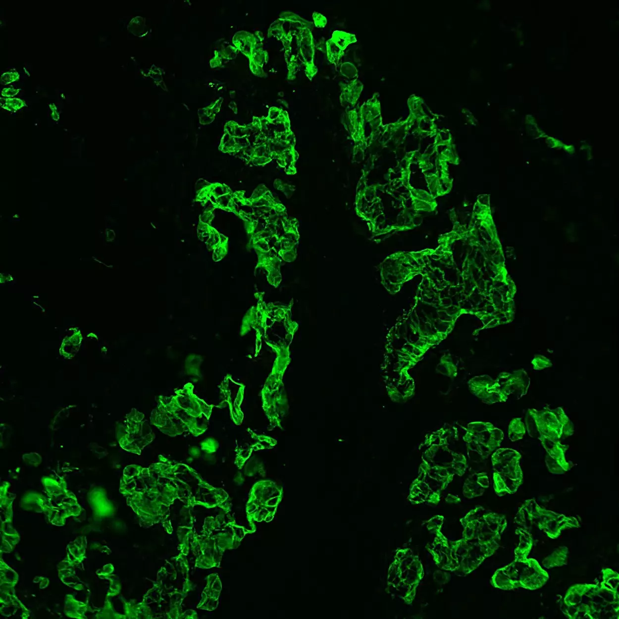 Anti-Cytokeratin (CK3-6H5) p, h