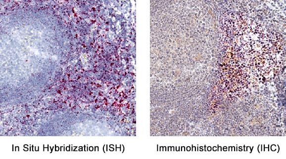 hCCR7 MAb (Cl 150503 (25 ug)