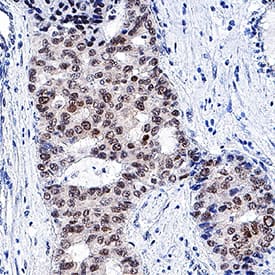 Human/Mouse/Rat HNF-3 beta/FoxA2 MAb (Clone 2141A) (25 UG)