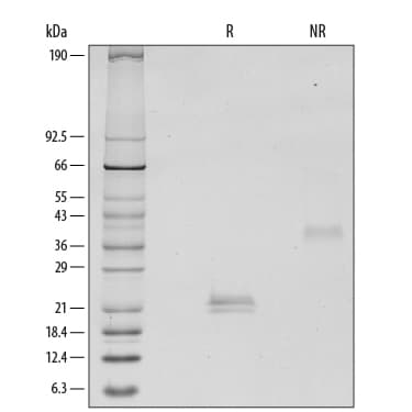 rhVEGF 165, CF (1 mg)