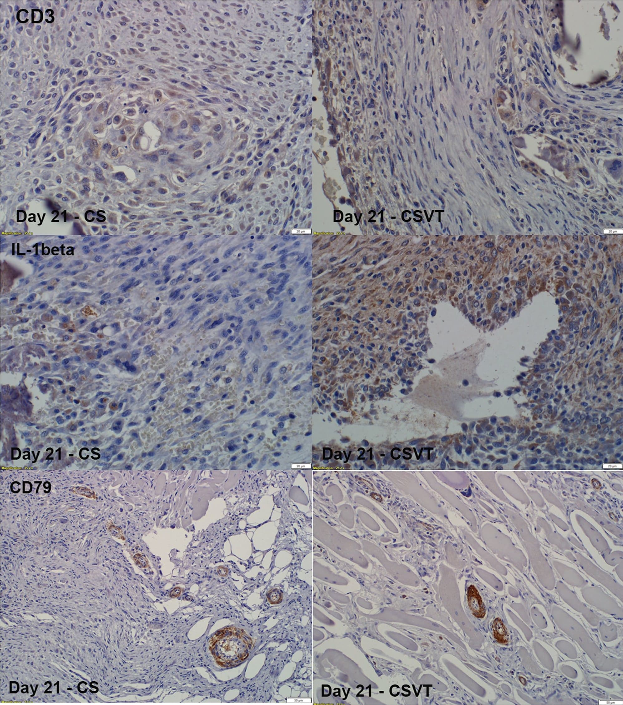 hIL-1b MAb (Cl 8516) (25 ug)