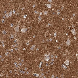 Human NCAM-1/CD56 MAb (Clone 301021) (25 ug)