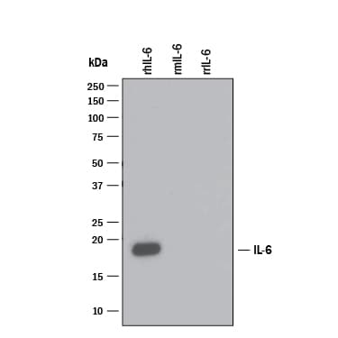 h/prIL-6 MAb (Cl 670 (25 ug)