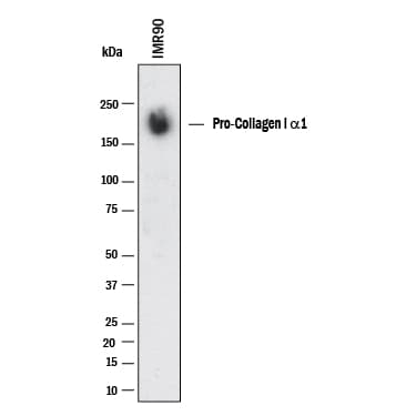 hProCOL1A1 PAb (25 ug)