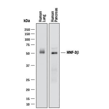 Human/Mouse/Rat HNF-3 beta/FoxA2 MAb (Clone 2141A) (25 UG)