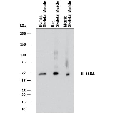 hIL-11 Ra MAb (Cl 10 (25 UG)