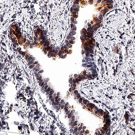 h/m/rTrx-1 MAb (Cl 7 (25 UG)