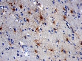 hNCAM-1 MAb (Cl 3010 (25 ug)