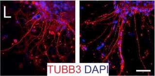 b-III Tubulin MAb (C (100 ug)