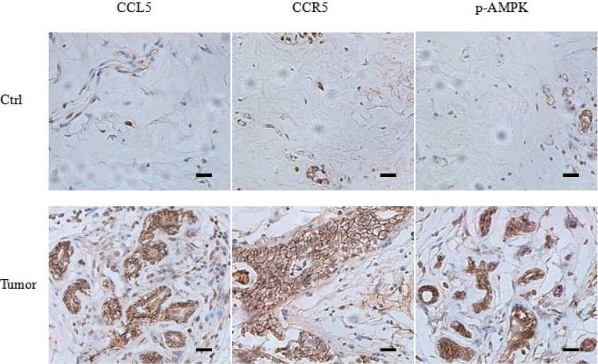 hCCR5 MAb (Cl 45523) (100 ug)