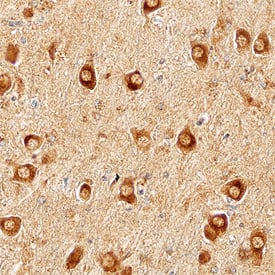 hN-Cadherin MAb (Cl (25 ug)