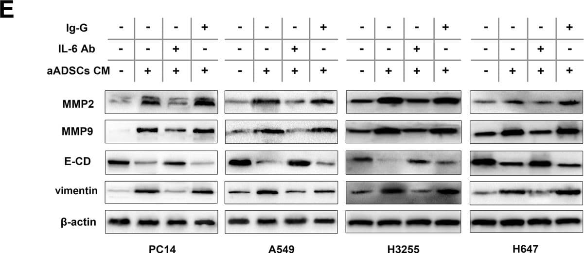 h/prIL-6 MAb (Cl 670 (25 ug)