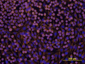 mIntegrin b1 MAb (Cl (25 ug)