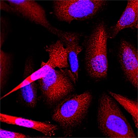 hTrx-1 MAb (Cl 76362 (25 UG)