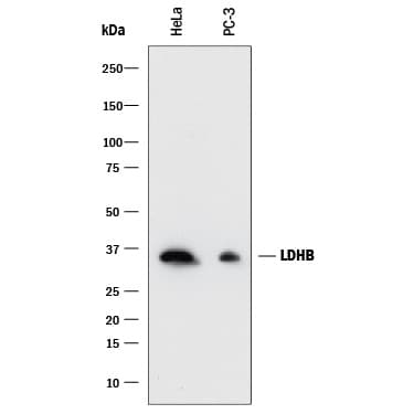 hLDHB MAb (Cl 2057D) (25 ug)