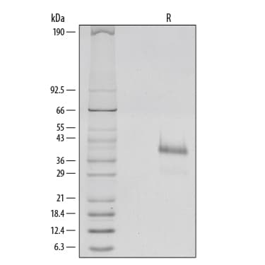 rhR-Spondin 1, CF (1 mg)