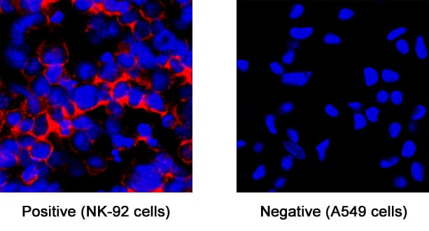 h/rNCAM-1 MAb (Cl 25 (25 UG)