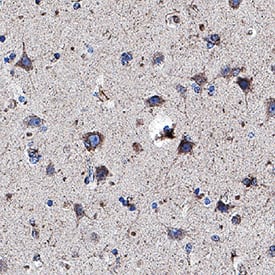 hLRP-1 CII MAb (25 ug)